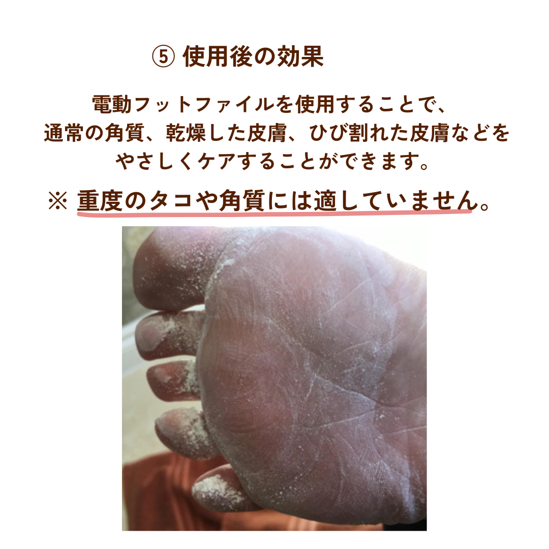 +2,520人以上が満足（4.8/5）Smoothy（スムージー）フットケア