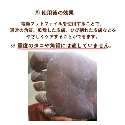 +2,520人以上が満足（4.8/5）Smoothy（スムージー）フットケア
